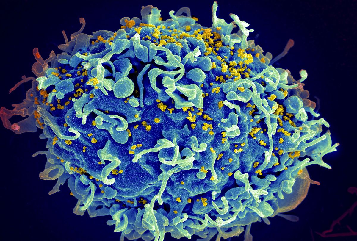 Scientists just used CRISPR to cure the simian equivalent of HIV. Here's why this is a big deal