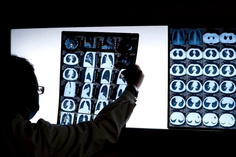 Physicians urge preventative screenings this Lung Cancer Awareness Month